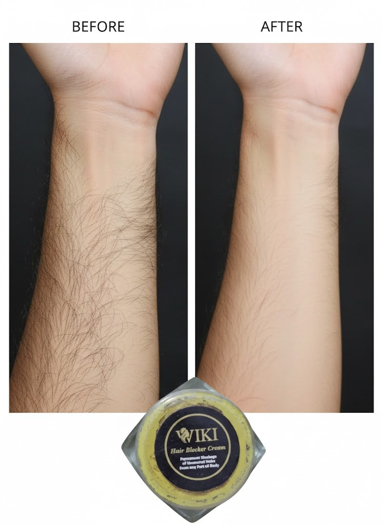 WIKI Hair Blocker Cream - Permanent Hair Removal Solution